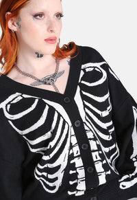 Skeleton Cardigan